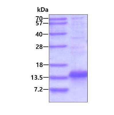 SDS-PAGE Recombinant Human SERF2 His Protein